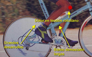 reparaciones de bicicletas en mendoza Bicicletería Taller Cordón